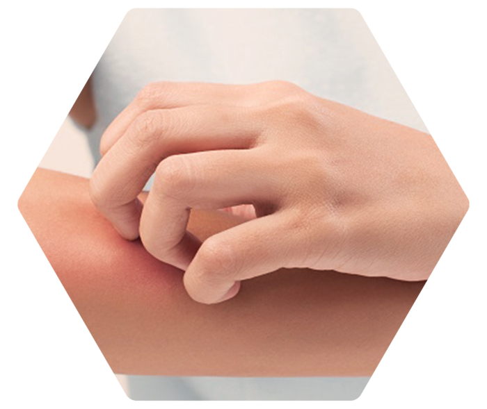 Eine linke Hand kratzt am rechten Unterarm.