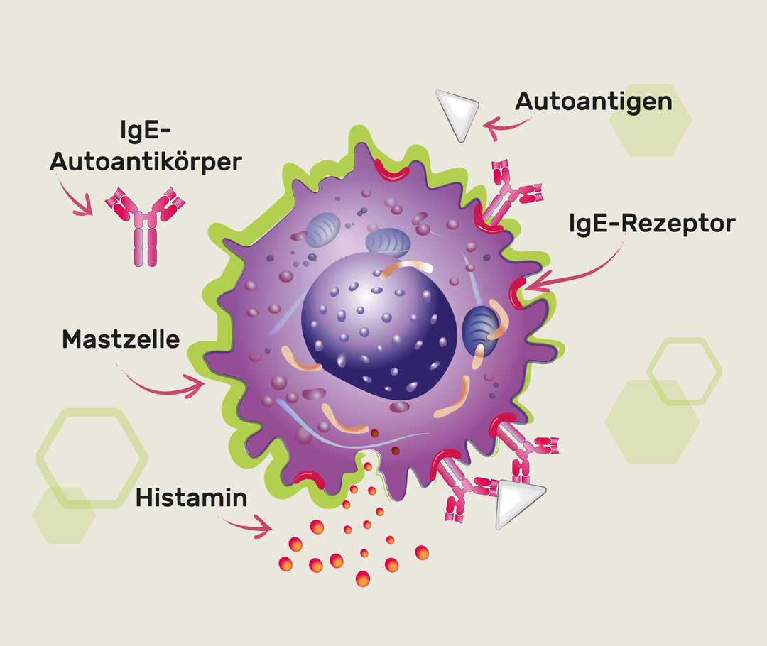 Wann setzen Mastzellen Histamin frei?